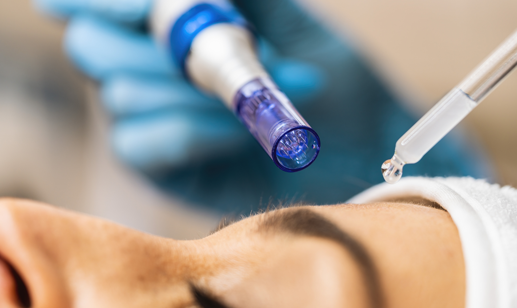 Microneedling